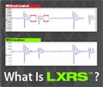 Lossless Extended Range Synchronized